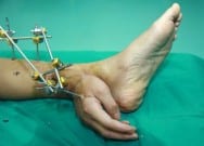 Kopan el bacağa dikildi