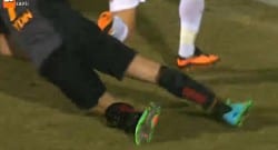 Aydın’ın sakatlığı oyuncuları ağlattı!