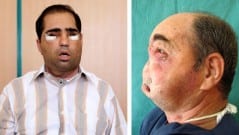 Yüzü geri alınacak!