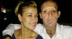 Yüz nakli olan Recep Sert’ten Seda Sayan’a tepki!