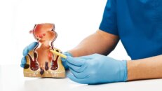 Vezikovajinal Fistül Nedir? Tedavisi Nasıl Olur?