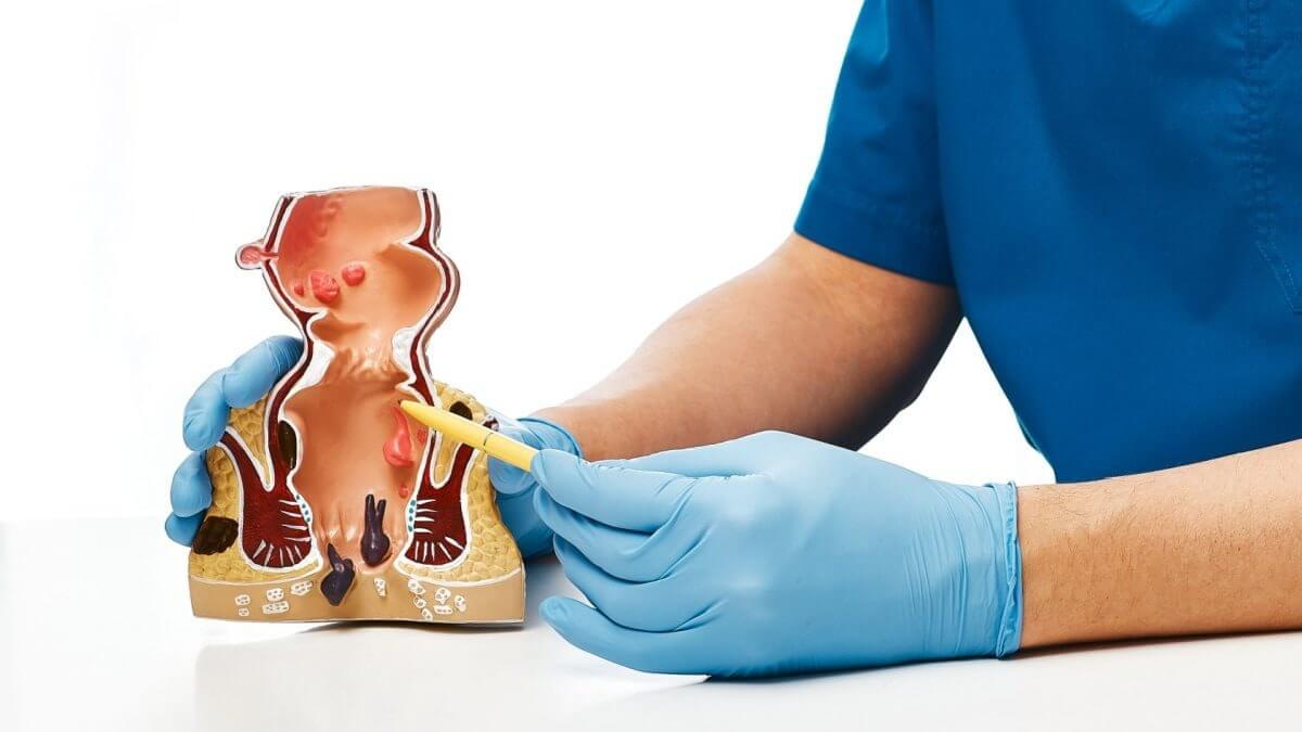 Vezikovajinal Fistül Nedir? Tedavisi Nasıl Olur?